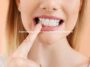 Common Signs Your Gums Need Extra Attention
