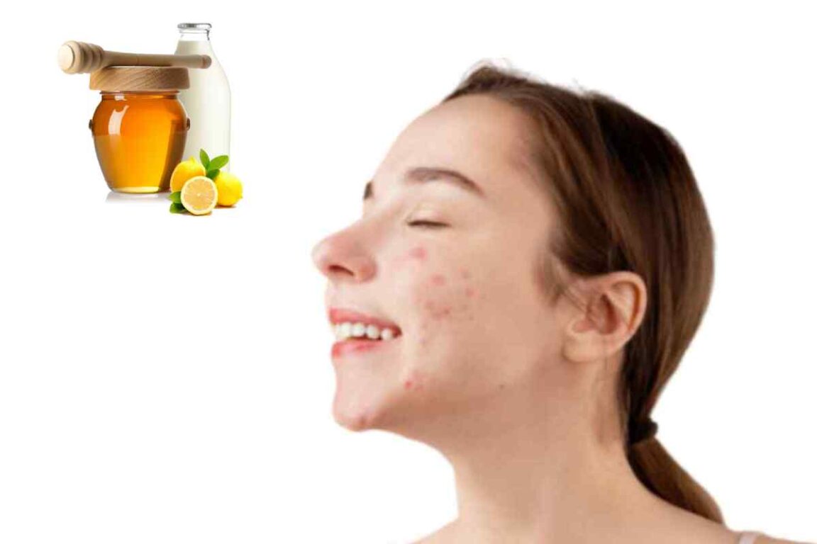 Wellhealthorganic.Com : Remove Dark Spots On Face Tang - Lemon Juice