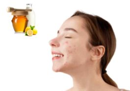 Wellhealthorganic.Com : Remove Dark Spots On Face Tang - Lemon Juice