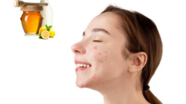 Wellhealthorganic.Com : Remove Dark Spots On Face Tang - Lemon Juice